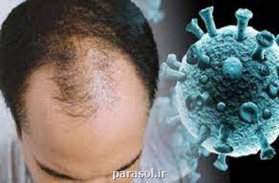 ریزش مو از عوارض جدید مبتلاشدن به کووید ۱۹