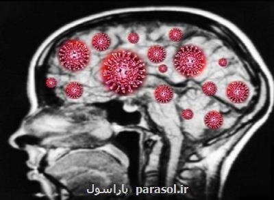 عفونت کووید ۱۹ بیش از آلزایمر به مغز لطمه می رساند