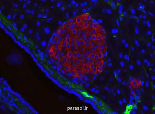 بازسازی سلول های بتا پانکراس و درمان دیابت