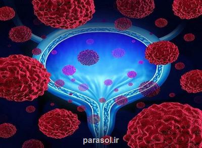 نقش هورمون ها در تفاوت جنسیتی مبتلاشدن به سرطان مثانه