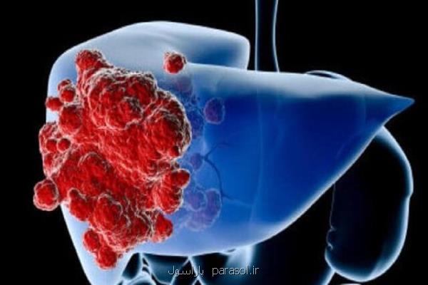 علایم سرطان کبد چیست؟