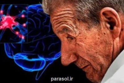 شناسایی مشاغلی که ریسک مبتلاشدن به ALS را می افزایند