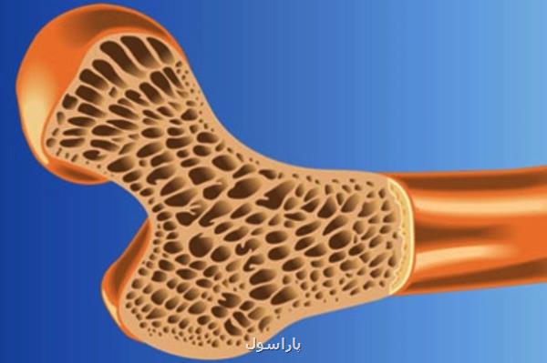 ورزش بسکتبال بهتر از دویدن به استحکام استخوان ها کمک می کند