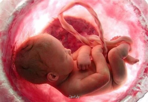 پره اکلامپسی در حاملگی سبب کندشدن روند رشد جنین می شود