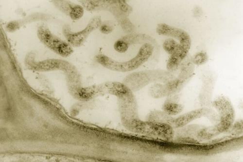 شناسایی یک باکتری که سبب بروز اندومتریوز می شود
