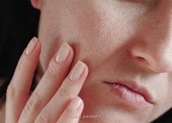 میوه ای که پوست صورت را جوان نگه می دارد