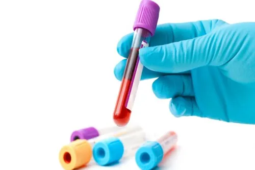 گفت و گو با مردی که خونش در ایران کمیاب تر از الماس است