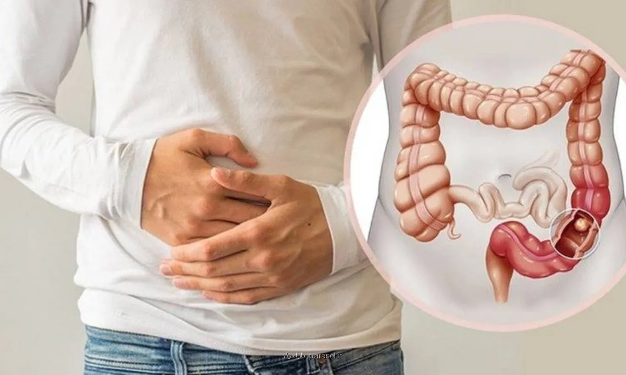 چرا بعضی یبوست ها درمان سخت تری دارند؟