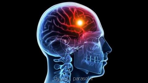 نشانه های سكته مغزی