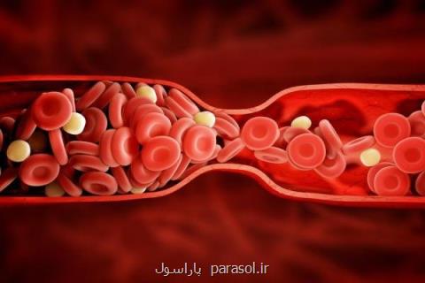 فاكتورهای پرخطر لخته شدن خون را بشناسیم