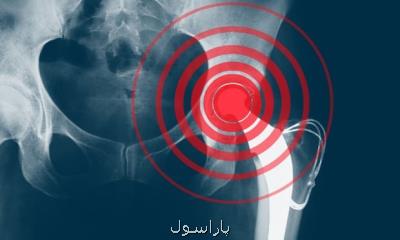 ۳ سفارش كلیدی درباره پوكی استخوان